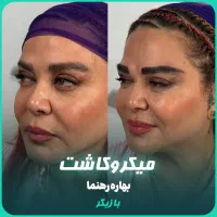 جشنواره نقد و اقساط کاشت مهرزاد