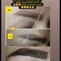 محلول رویش و رشد مجدد ابرو و مژه ملک|آرایشی، بهداشتی، درمانی|شاهرود, |دیوار