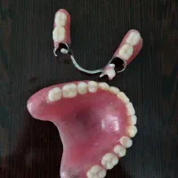 دندان مصنوعی(دست دندان )|خدمات آرایشگری و زیبایی|مرند, |دیوار