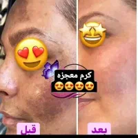 کرم معجزه اصل با کیفیت|آرایشی، بهداشتی، درمانی|بناب, |دیوار