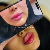 جشنواره50% ژل بوتاکس آنزیم خال مزو زگیل لابیا زگیل|خدمات آرایشگری و زیبایی|کرمانشاه, |دیوار