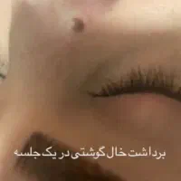 پاکسازی پوست دائمی|خدمات آرایشگری و زیبایی|قرچک, میرزائی جنوبی|دیوار