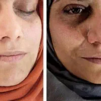 کرم معجزه اصل