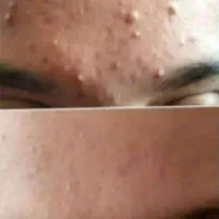 متخصص پوست و موهمراه مشاوره‌  وروتین پیشنهاد محصول|خدمات آرایشگری و زیبایی|اردبیل, |دیوار