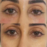 لیفت تخصصی صورت و ابرو فقط امرور با ۴۰ درصد تخفیف|خدمات آرایشگری و زیبایی|شیراز, بعثت|دیوار