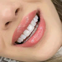 دندانپزشکی لمینت کامپوزیت ایمپلنت ارتودنسی|خدمات آرایشگری و زیبایی|آذرشهر, |دیوار