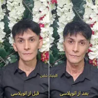 عمل جراحی پلک(بلفاروپلاسی)جراحی گوش(اتوپلاسی)|خدمات زیبایی و سلامت|تهران, آبشار تهران (دریاچه)|دیوار