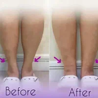 آفر ویژه خدمات زیبایی ژل فیلر بوتاکس لیفت|خدمات آرایشگری و زیبایی|شاهینشهر, طالقانی|دیوار