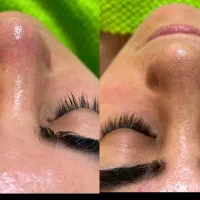 offویژه فیشیال تخصصی براخانم‌هاآقایون تحت نظر پزشک