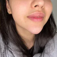 خدمات ژل و بوتاکس|خدمات آرایشگری و زیبایی|ساری, |دیوار