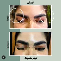 کانتورینگ با فیلر و ژل و لب تخصصی (کاملا طبیعی)|خدمات آرایشگری و زیبایی|مشهد, گلبرگ شمالی|دیوار