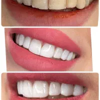 درمانگاه دندانپزشکی/کف قیمتی/طرف قراردادبیمه ها|خدمات زیبایی و سلامت|شیراز, عفیفآباد|دیوار
