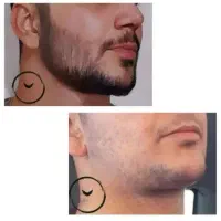 ریش پرپشت توی 18 روز