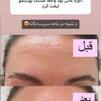محصولات جوانساز ضد چین وچروک|آرایشی، بهداشتی، درمانی|تهران, الهیه|دیوار