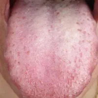 آشنایی با علم زبانشناسی و تشخیص بیماریها|خدمات آموزشی|زاهدان, |دیوار