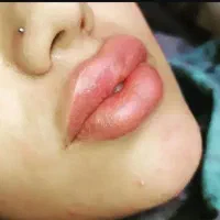 مرکز تخصصی (درمانی-زیبایی) آقایان در شوشتر|خدمات آرایشگری و زیبایی|شوشتر, |دیوار