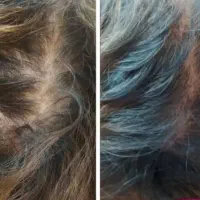 مدل ژل و بوتاکس و پوست و خدمات لیزر|خدمات زیبایی و سلامت|اصفهان, سعادتآباد|دیوار