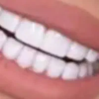 مرکز  پروتز. دندانی مهر دنتال
