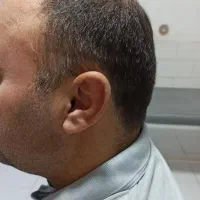 کلینیک تخصصی شنوایی و سمعک نرخ دولتی(اقساطی)|آرایشی، بهداشتی، درمانی|تهران, افسریه جنوبی|دیوار