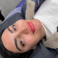 میکروبلیدینگ شیدینگ لب چشم اسکالپ ریموو فیبروز