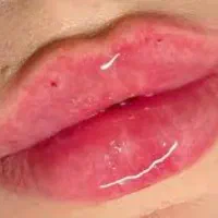 جوانسازی فوق حرفه‌ای