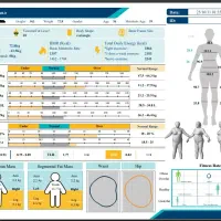 لاغری با دستگاه جلسه ای 150 هزارتومان(فقط تا۶ آذر)|خدمات آرایشگری و زیبایی|مشهد, دانشجو|دیوار