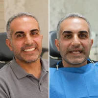 ایمپلنت دیجیتال با شرایط پرداخت 450 روزه بدون سود