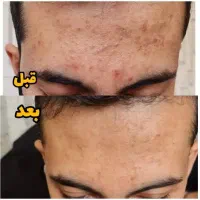 پاک کردن کبد چرب و معده