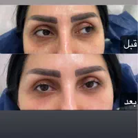 آموزش و تزریق انواع فیلر ،بوتاکس لیفت نخ، هیپ دیپ|خدمات آرایشگری و زیبایی|تهران, نیروی هوایی (پیروزی)|دیوار