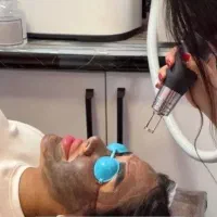 لیزر موهای زائد رایگان (ریزش تضمینی)فیشال