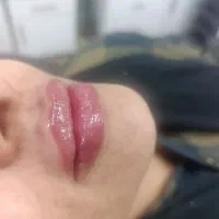 دنبال کارم انجام تزریقات ژل و بوتاکس