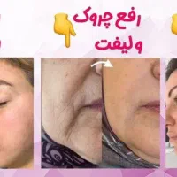 روتین رفع چروک و جوش