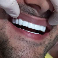 کامپوزیت زیبایی دندان پزشکی|خدمات آرایشگری و زیبایی|یاسوج, |دیوار