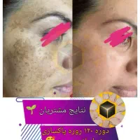 تشخیص بیماریها از روی زبان و درمان|خدمات آرایشگری و زیبایی|جیرفت, |دیوار