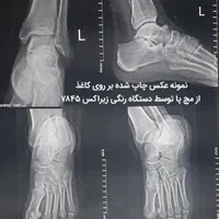 فروش و سرویس دستگاه کپی و پرینتر زیراکس|پرینتر، اسکنر، کپی، فکس|تهران, ایرانشهر|دیوار