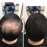 پیرایش مردانه ژون