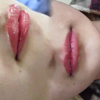 فیشال صورت ،درمان مو ،تزریق ژل صورت|خدمات آرایشگری و زیبایی|کارون, |دیوار