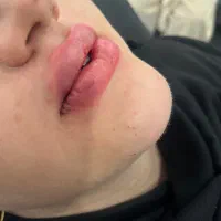چانه لب سیب گونه خط خنده خط اخم