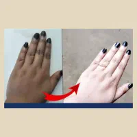 سفید کننده آنی بعد از استفاده همون لحظه سفید شو