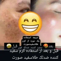 کرم شب|آرایشی، بهداشتی، درمانی|قم, شاه ابراهیم|دیوار