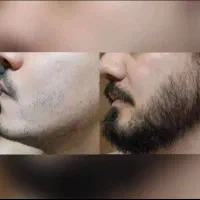 شبا بزن در بیاد