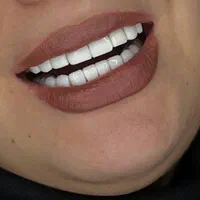 خدمات دندانپزشکی|خدمات آرایشگری و زیبایی|کرج, حصارک بالا|دیوار