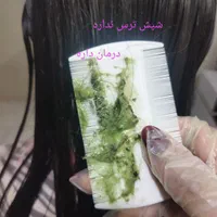 درمان سریع و گیاهی رشک و شپش بدون مواد شیمیایی|خدمات آرایشگری و زیبایی|یزد, |دیوار
