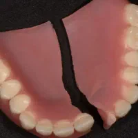 میز تلفن ترمیم دندان مصنوعی