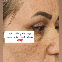 کرم معجزه شب|آرایشی، بهداشتی، درمانی|بندر گز, |دیوار