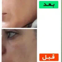 درمان پوست ومو|آرایشی، بهداشتی، درمانی|نهبندان, |دیوار