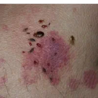 سمپاشی حشرات سم پاشی ساس سوسک تضمینی|خدمات نظافت|قم, انسجام|دیوار