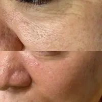 پیراپزشک طب سنتی متخصص پوست|خدمات آرایشگری و زیبایی|رشت, رودباری|دیوار
