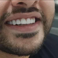 دندانپزشکی دندون طلا