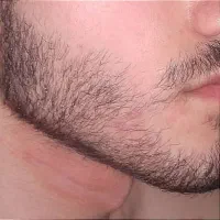 راهکار پرپشت شدن ریش